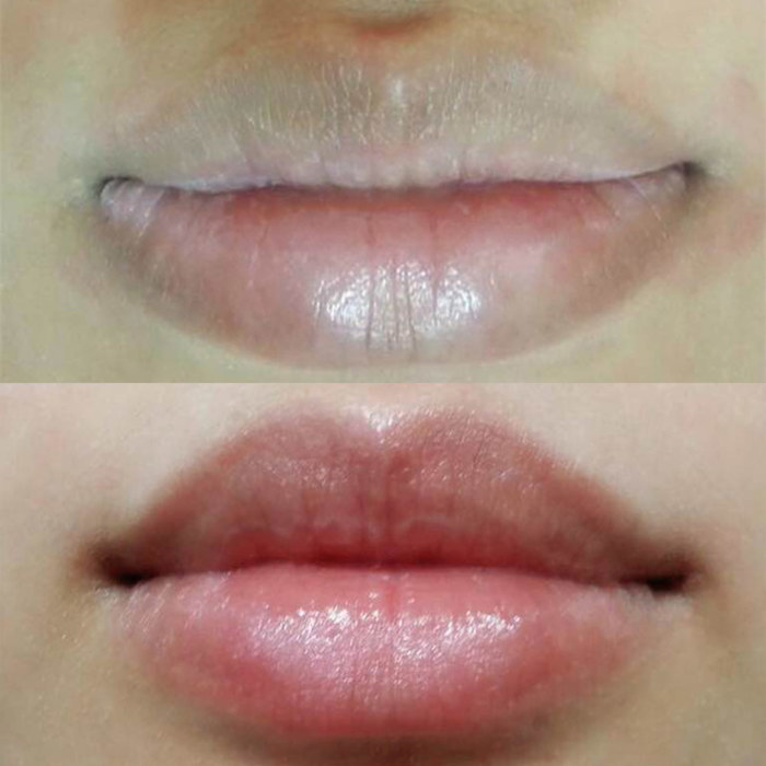 pink lips with permanent make-up (PMU), example of lip treatment, comparison before and after