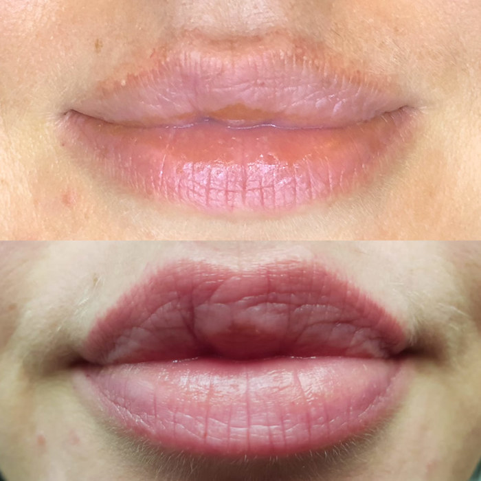 Foto von Lippen mit Permanent Make-Up (PMU), Beispiel PMU Behandlung Augenlid Eyeliner, Nahaufnahme Vergleich Vorher und Nachher