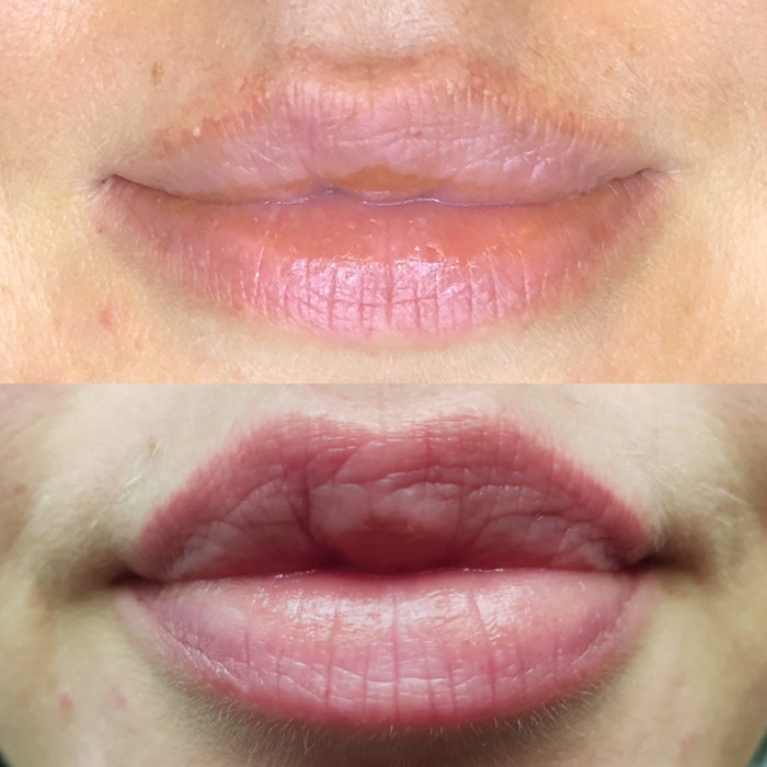 natural lips with permanent makeup (PMU), example of lip treatment, comparison before and after