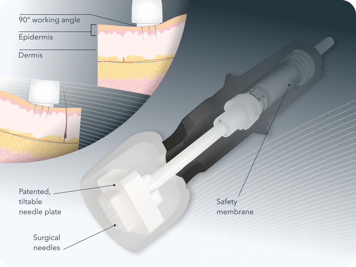 Microneedling_Produktbild04_Technisches_1