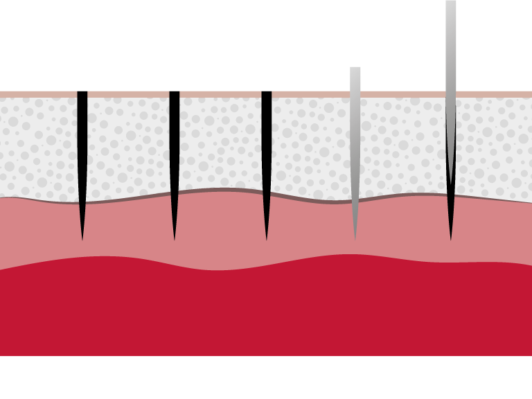 skin with a Permanent Makeup treatment 