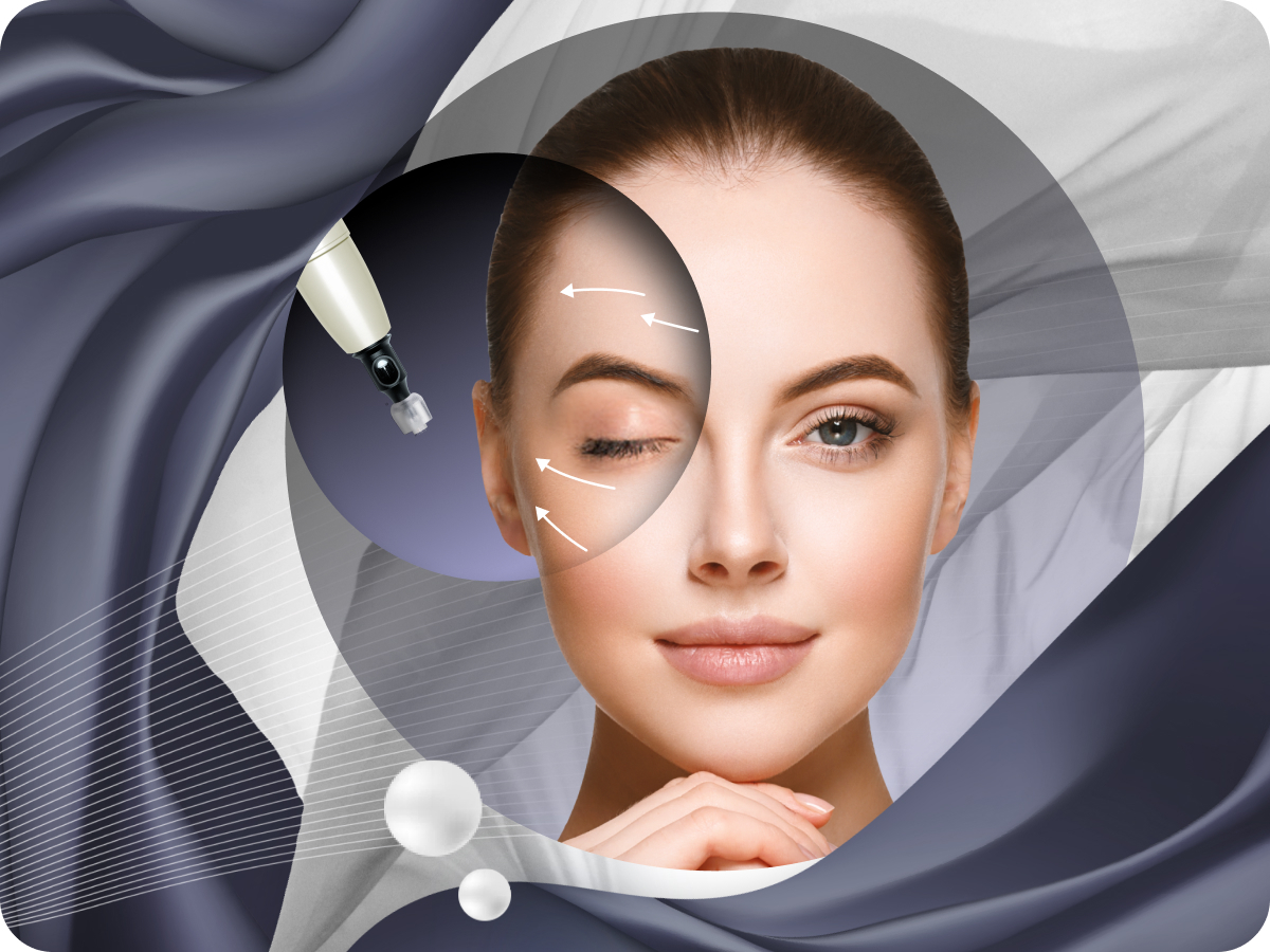 Microneedling_Produktbild01